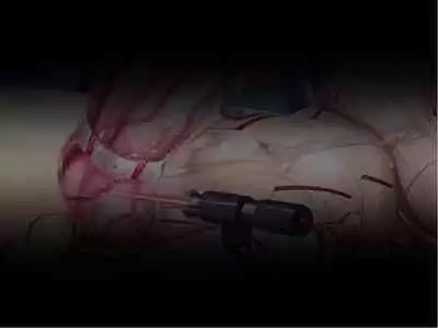 [Courreges Accel] Senkou no Ikusu -Disorder Eclipse- | 生物兵器战姬 伊克斯 [Chinese] [机翻汉化]