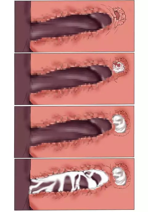 レイジュお仕置きぱんぱん